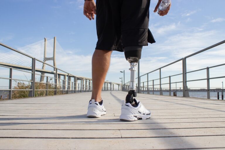 What Results Can Patients Anticipate with a Transtibial Prosthetic Leg