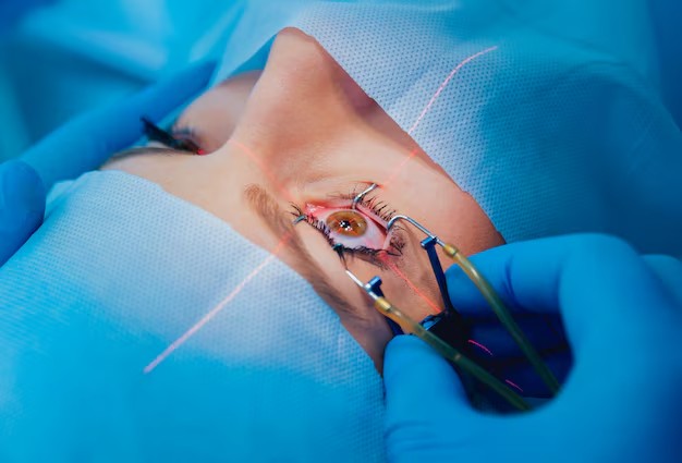 Tips for Preparing for Your First Adelaide Laser Eye Surgery