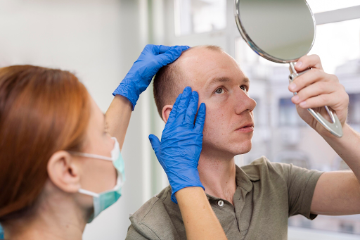 What To Expect From FUE Hair Transplant Procedures In Florida