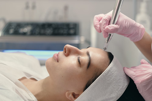 How Microneedling Supports Collagen Production And Skin Health