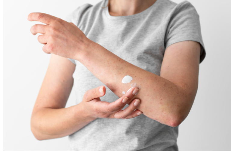 Daily Habits That May Help Reduce Skin Irritation for Eczema-Prone Ski Daily Habits That May Help Reduce Skin Irritation for Eczema-Prone Skin