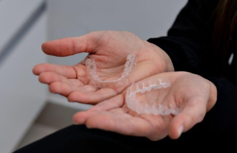 Clear Aligners: What You Should Know Before You Commit