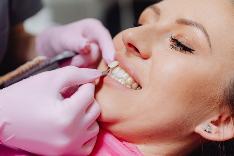 Veneers Reimagined: How Technology Is Redefining the Perfect Smile
