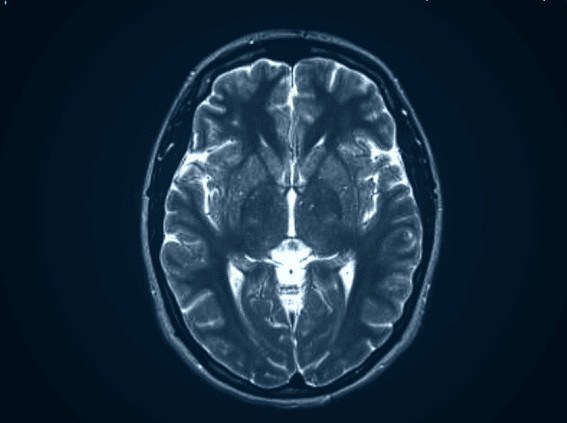 Can You Recover Damages for Delayed-Onset Brain Injury Symptoms in Columbia, SC? Can You Recover Damages for Delayed-Onset Brain Injury Symptoms in Columbia, SC?