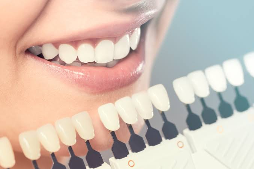 Achieving a Natural Looking Smile Through Modern Dental Care